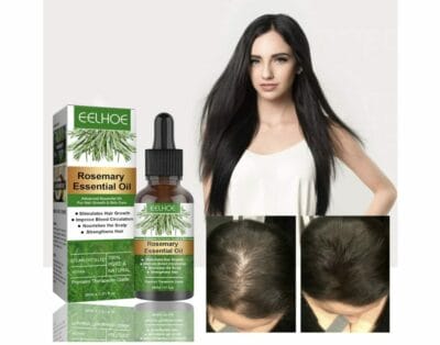 Rosmarinöl für Haar und Kopfhaut: Natürliches Haarwachstum, Anti-Haarausfall, strahlendes Haar und gesunde Haut. Entdecke die Vorteile!