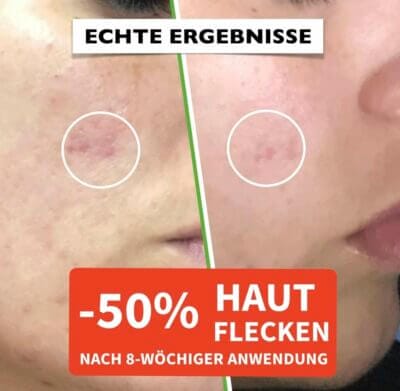 Bio Hyaluron Serum mit Vitamin C & E: Anti-Falten, Anti-Aging, ideal für Augenkontur und Dermaroller.