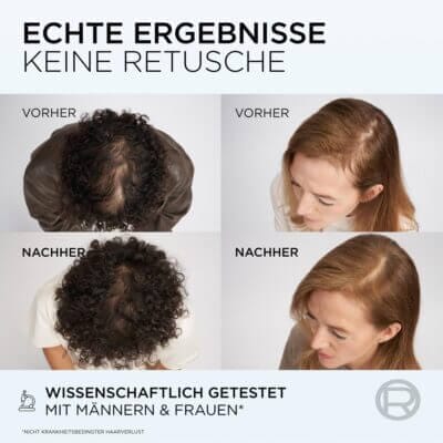 Wirkt nachweislich gegen Haarausfall. Übersicht mit Beispielen von L'Oreal Paris.