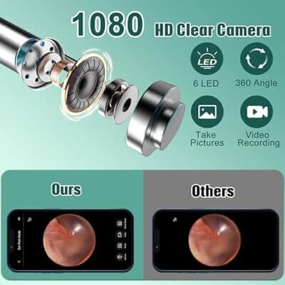 Ohrenschmalz Entferner Otoskop - 63% Rabatt 2 Ohrenschmalz Entferner Otoskop